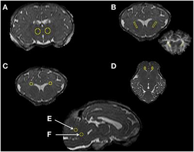 Diffusion Tensor Imaging Colour Mapping Threshold for Identification of Ventilation-Induced Brain Injury after Intrauterine Inflammation in Preterm Lambs